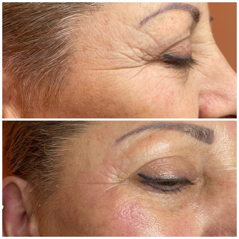 Eslife Zayıfla Güzellik ve Sağlıklı Yaşam Merkezi | Muğla