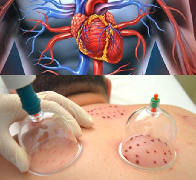 His Hacamat ve Bioenerji